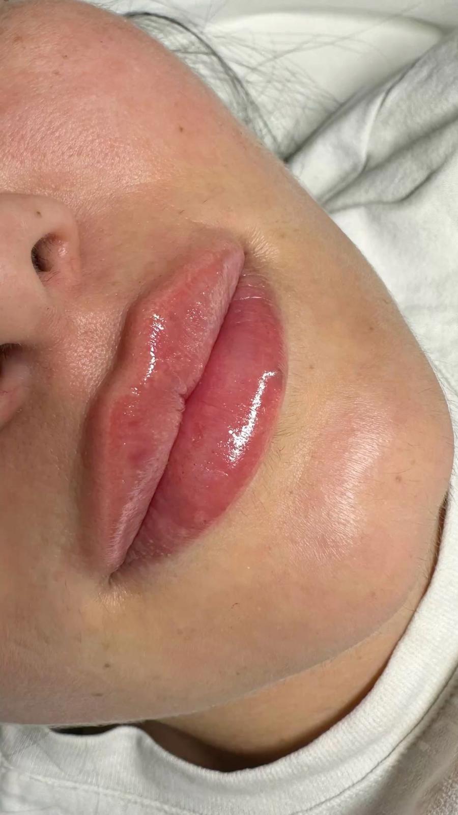 unnamed image